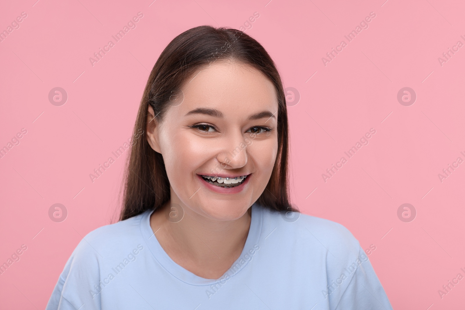 Photo of Smiling woman with dental braces on pink background