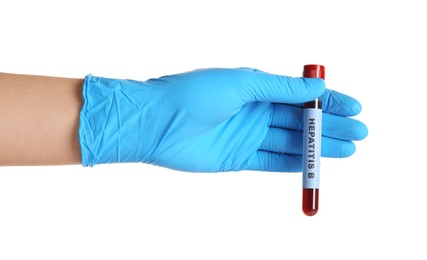 Photo of Scientist holding tube with blood sample and label Hepatitis B on white background, closeup