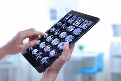 Image of Doctor examining x-ray images on tablet indoors, closeup