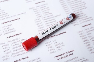 Tube with blood sample and label HIV TEST on laboratory form, closeup