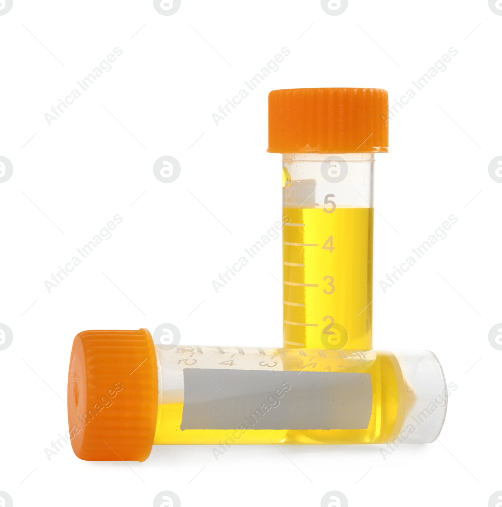 Photo of Containers with urine samples on white background, space for text. Laboratory analysis