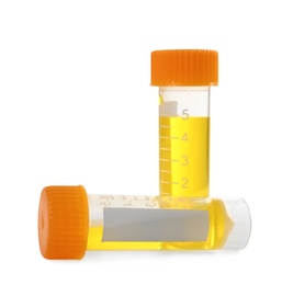Photo of Containers with urine samples on white background, space for text. Laboratory analysis