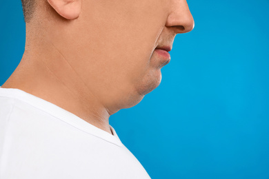 Photo of Mature man with double chin on blue background, closeup