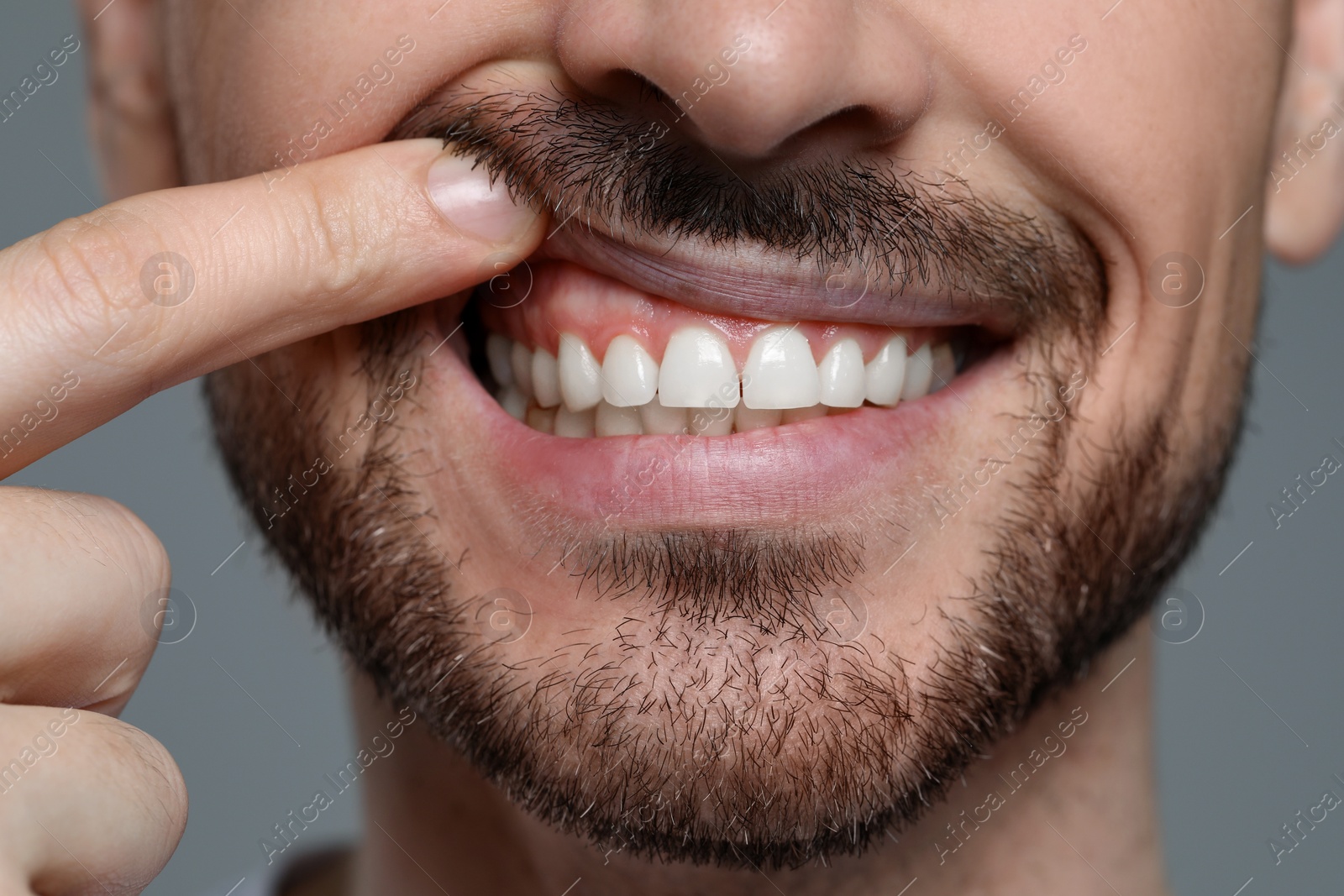 Photo of Man showing healthy gums on gray background, closeup