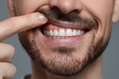 Photo of Man showing healthy gums on gray background, closeup