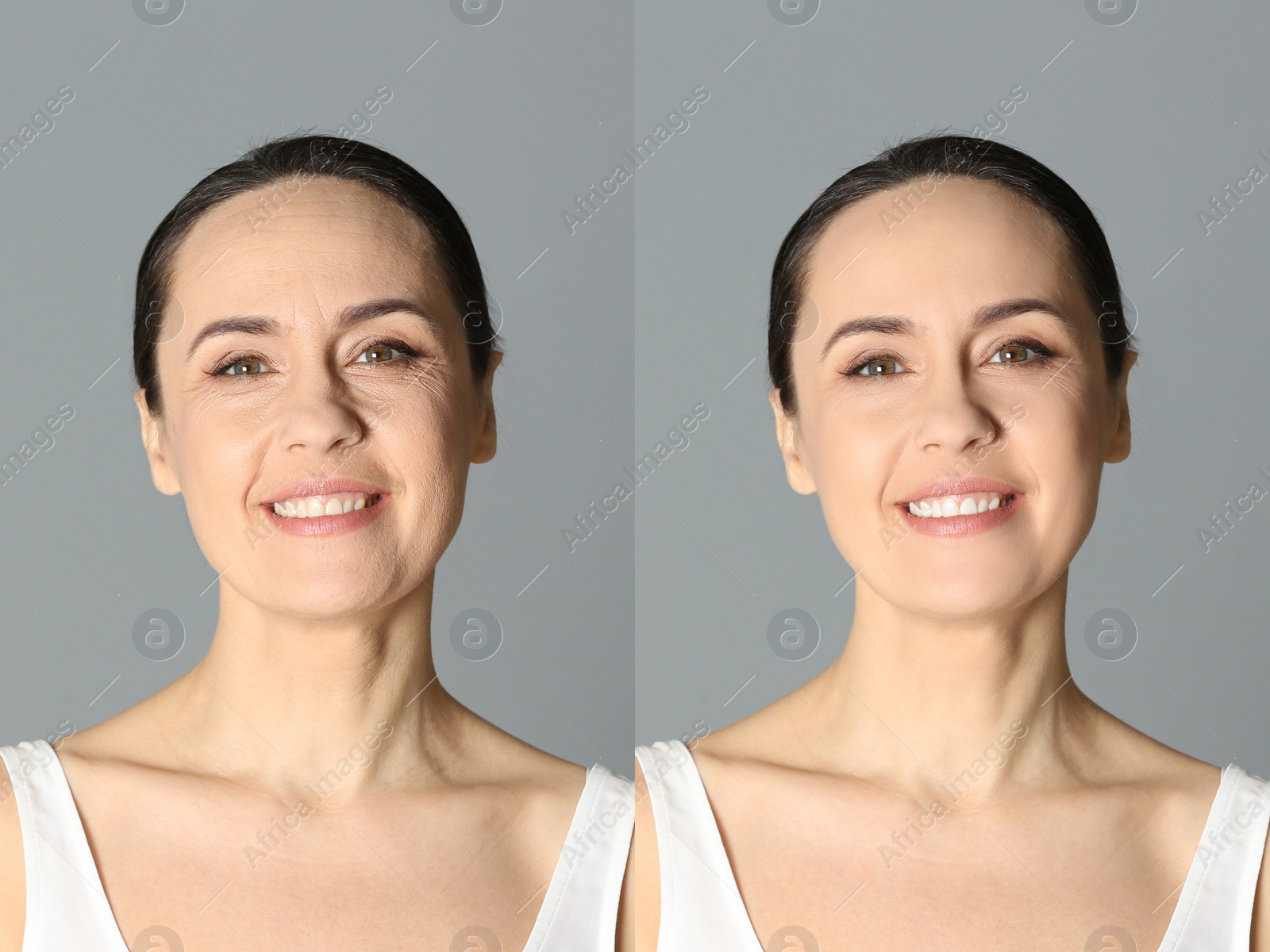 Image of Beautiful mature woman before and after cosmetic procedure on grey background, collage. Plastic surgery