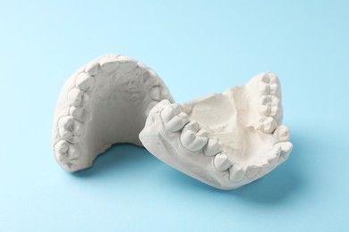 Dental model with gums on light blue background. Cast of teeth