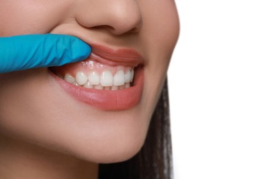 Photo of Doctor examining woman's gums on white background, closeup