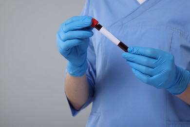 Laboratory testing. Doctor with blood sample in tube on light grey background, closeup