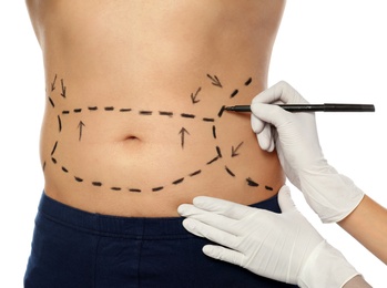 Doctor drawing marks on man's body for cosmetic surgery operation against white background, closeup