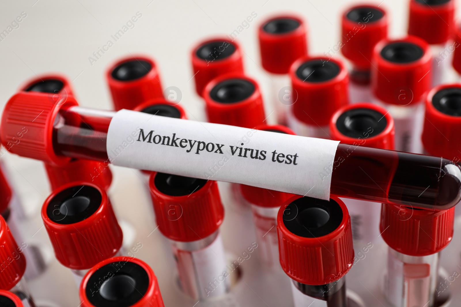 Photo of Monkeypox virus test. One sample tube with blood on others, closeup