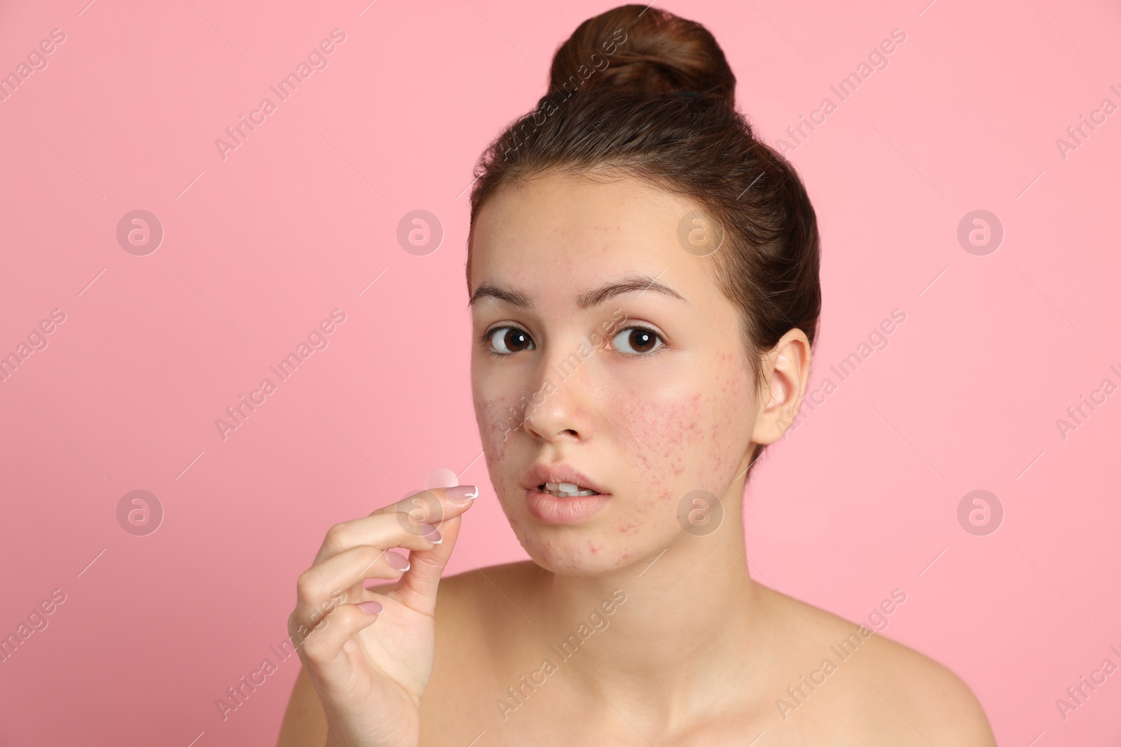 Photo of Teen girl applying acne healing patch on light pink background