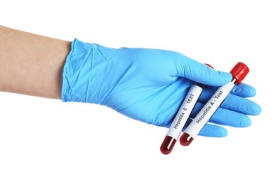 Photo of Scientist holding tubes with blood samples for hepatitis virus test on white background, closeup