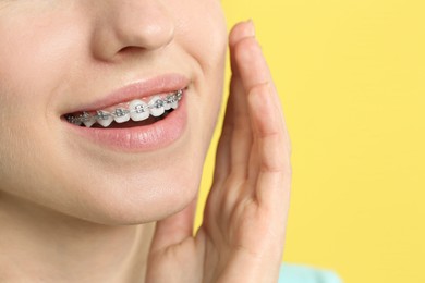 Smiling woman with dental braces on yellow background, closeup. Space for text