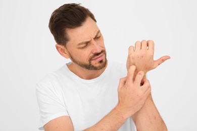 Photo of Man with rash suffering from monkeypox virus on beige background