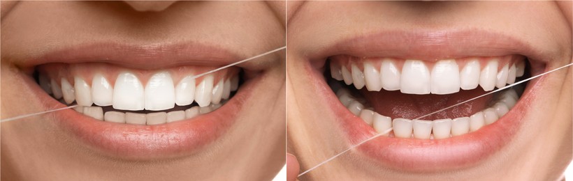 Collage with photos of woman using dental floss, closeup. Step by step instructions