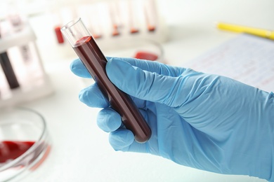 Scientist holding test tube with blood sample, closeup. Laboratory analysis