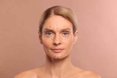 Photo of Portrait of beautiful woman with markings before cosmetic surgery on light brown background