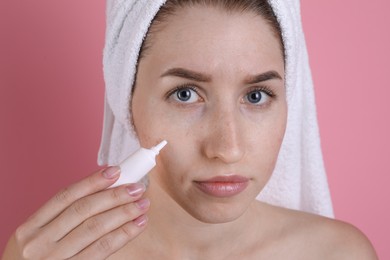 Young woman with acne problem applying cosmetic product onto her skin on pink background, closeup