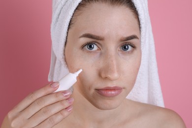 Photo of Young woman with acne problem applying cosmetic product onto her skin on pink background, closeup