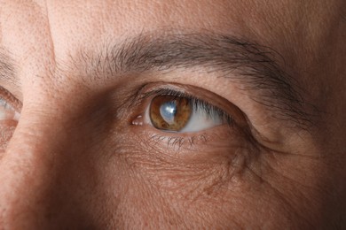 Photo of Closeup view of mature man suffering from cataract