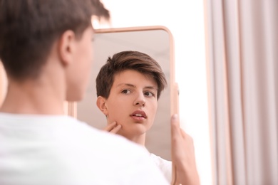 Photo of Teenage boy with acne problem looking in mirror at home