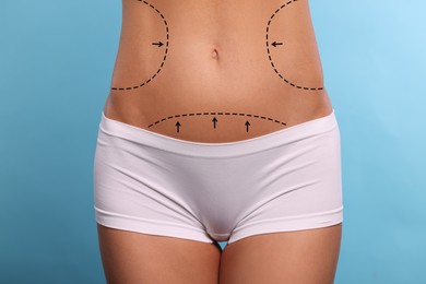 Woman with markings for cosmetic surgery on her abdomen against light blue background, closeup