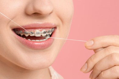 Woman with braces cleaning teeth using dental floss on pink background, closeup