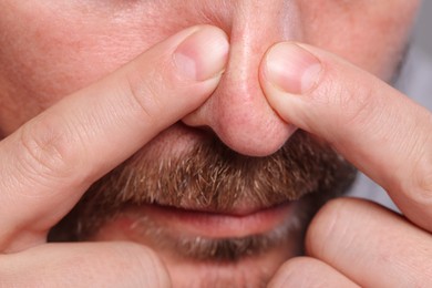 Photo of Man popping pimple on his nose, closeup