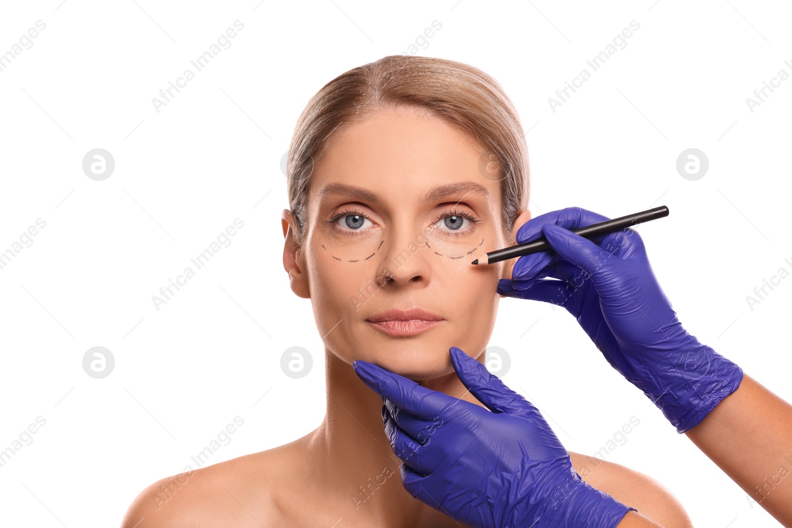 Photo of Doctor with pencil preparing patient for cosmetic surgery operation on white background