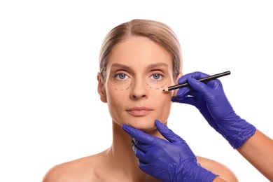 Photo of Doctor with pencil preparing patient for cosmetic surgery operation on white background