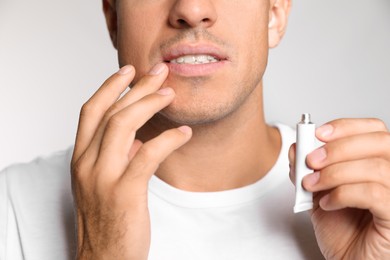 Photo of Man with herpes applying cream on lips against light grey background, closeup