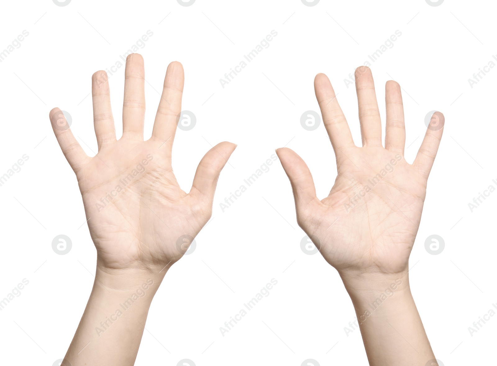 Image of Woman showing pale palms on white background, closeup. Anemia symptom