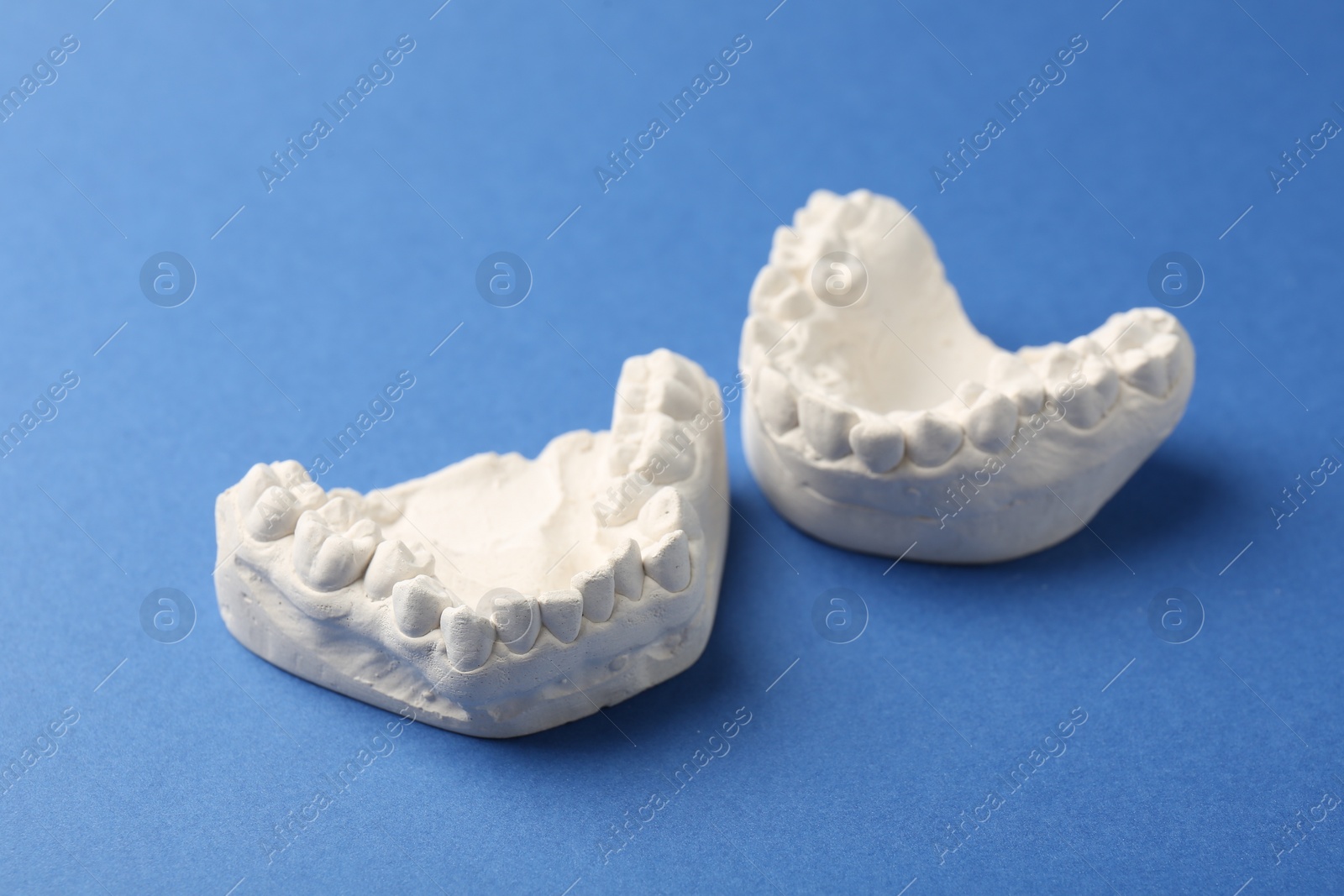 Photo of Dental model with gums on blue background. Cast of teeth