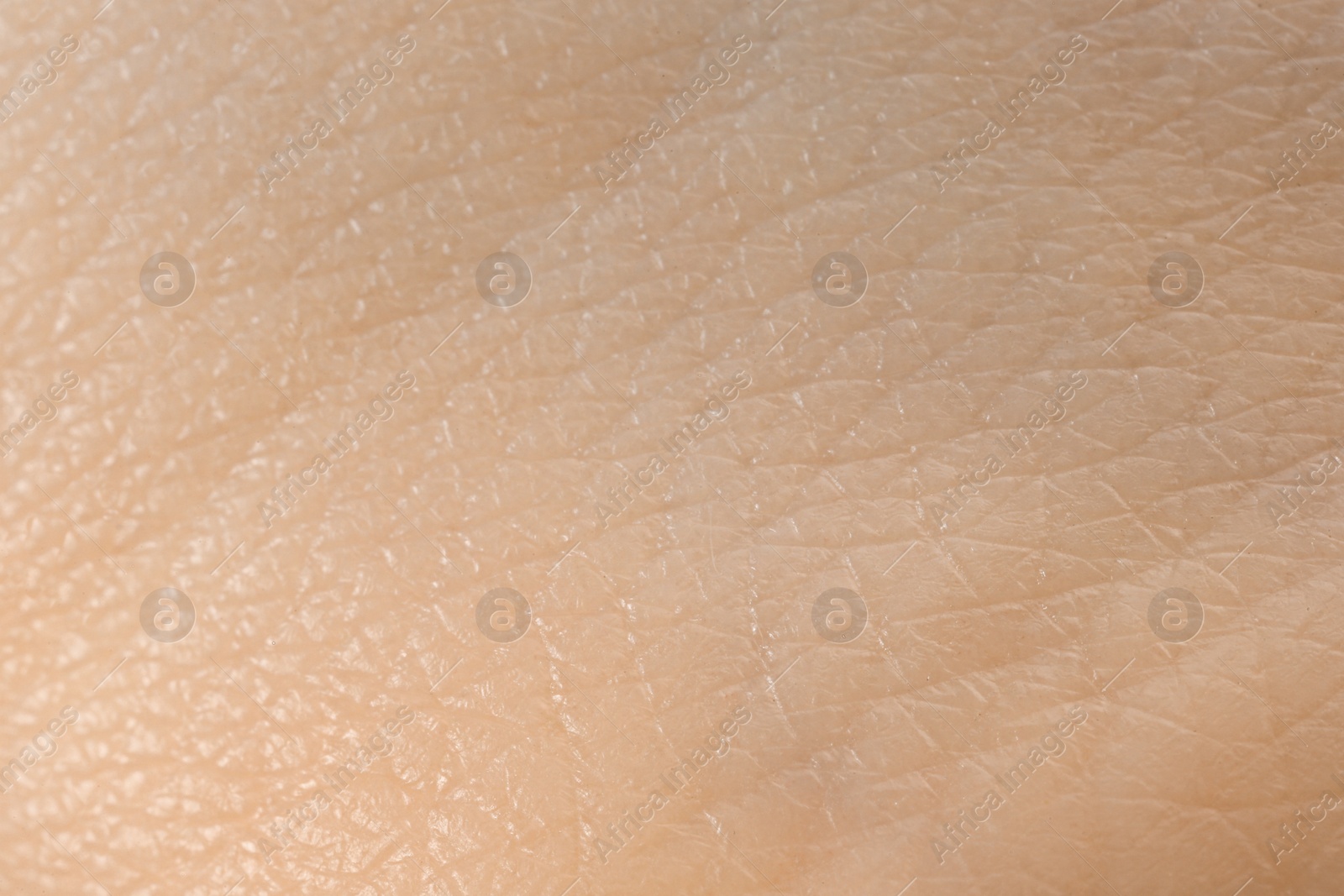 Photo of Texture of dry skin as background, macro view