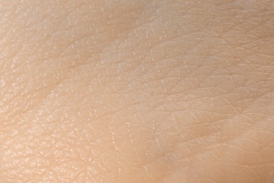 Photo of Texture of dry skin as background, macro view