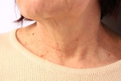 Skin care in beauty clinic. Senior woman, closeup view