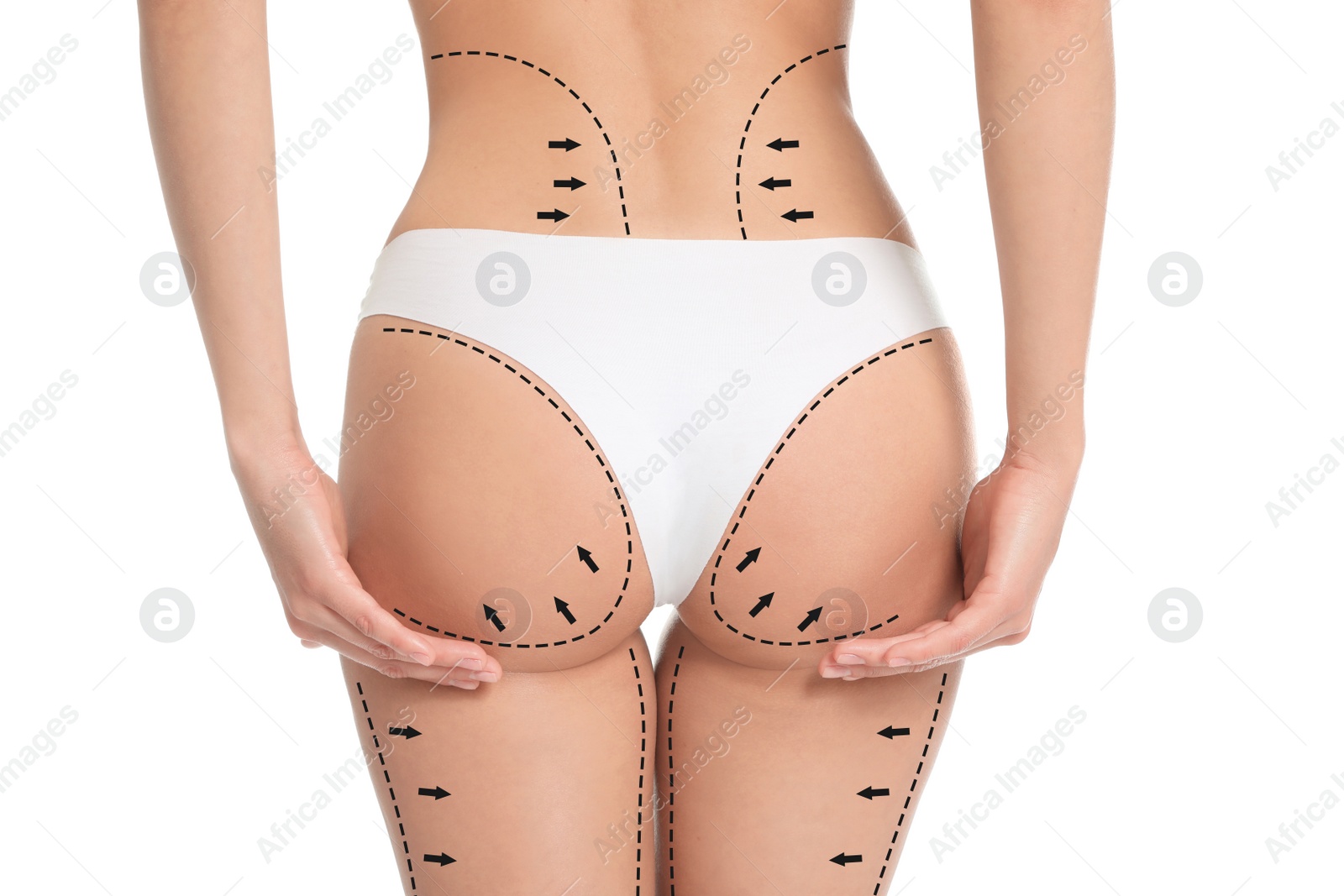 Image of Slim young woman with marks on body for cosmetic surgery operation against white background, closeup