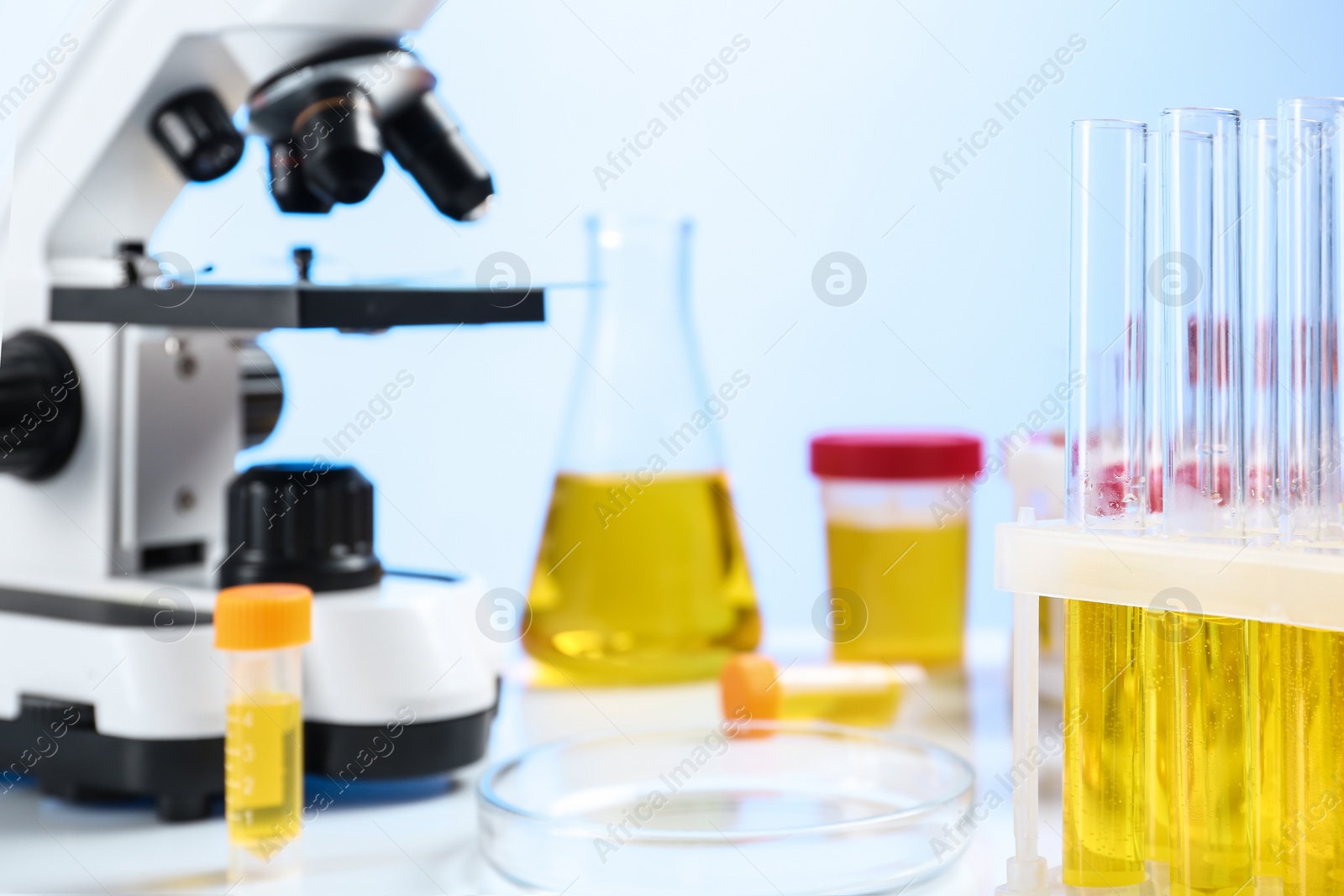 Photo of Test tubes with urine samples on table in laboratory, space for text. Medical analysis