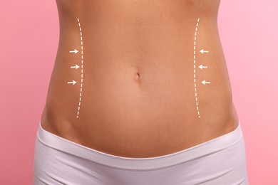 Image of Woman with markings for cosmetic surgery on her abdomen against pink background, closeup