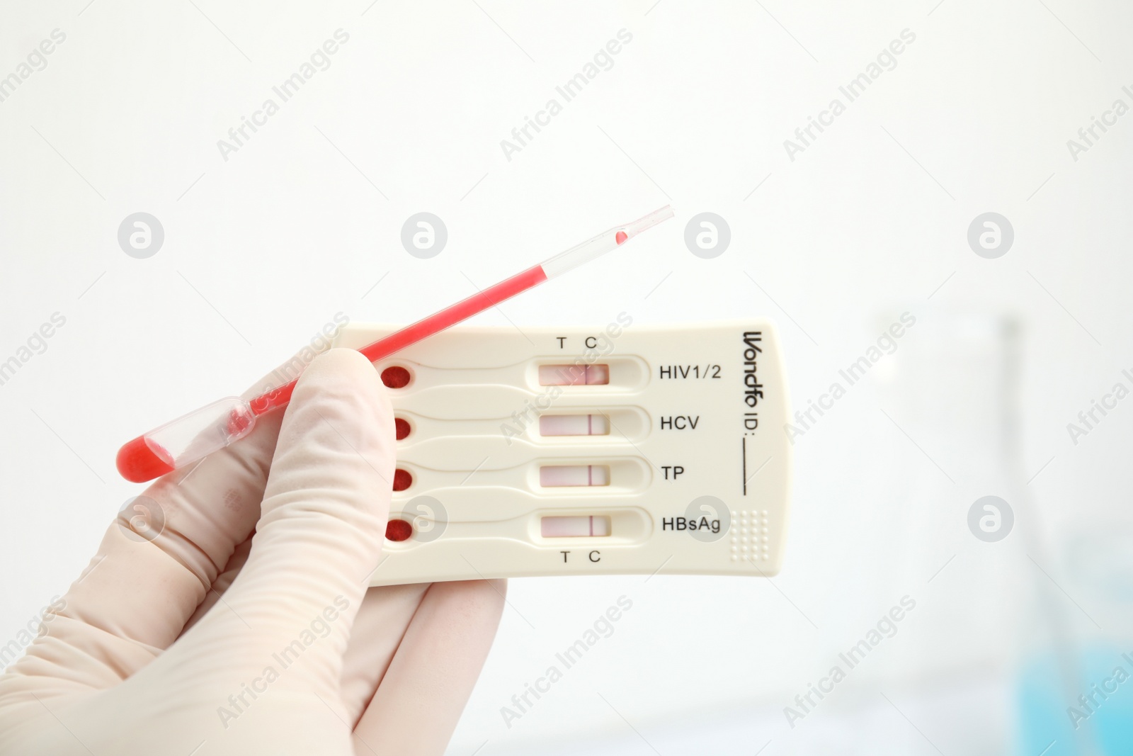 Photo of Doctor holding disposable express test for hepatitis and pipette with blood indoors, closeup
