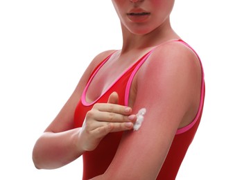 Photo of Woman applying cream on sunburn against white background, closeup