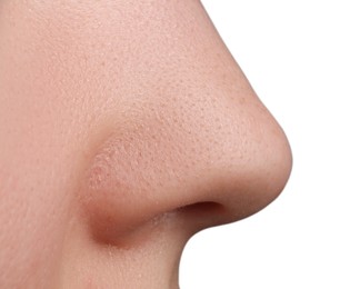Photo of Young woman with acne problem on white background, closeup view of nose