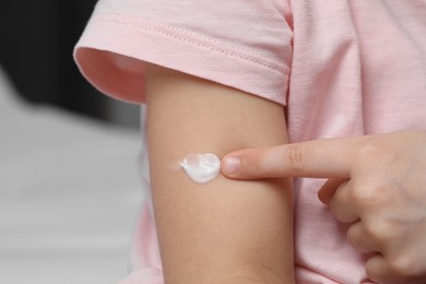 Little girl applying ointment onto her arm at home, closeup