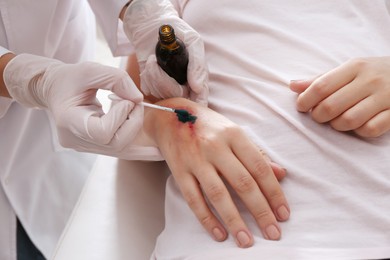 Doctor applying brilliant green onto injured hand, closeup
