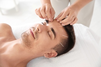 Photo of Young man undergoing acupuncture treatment in salon