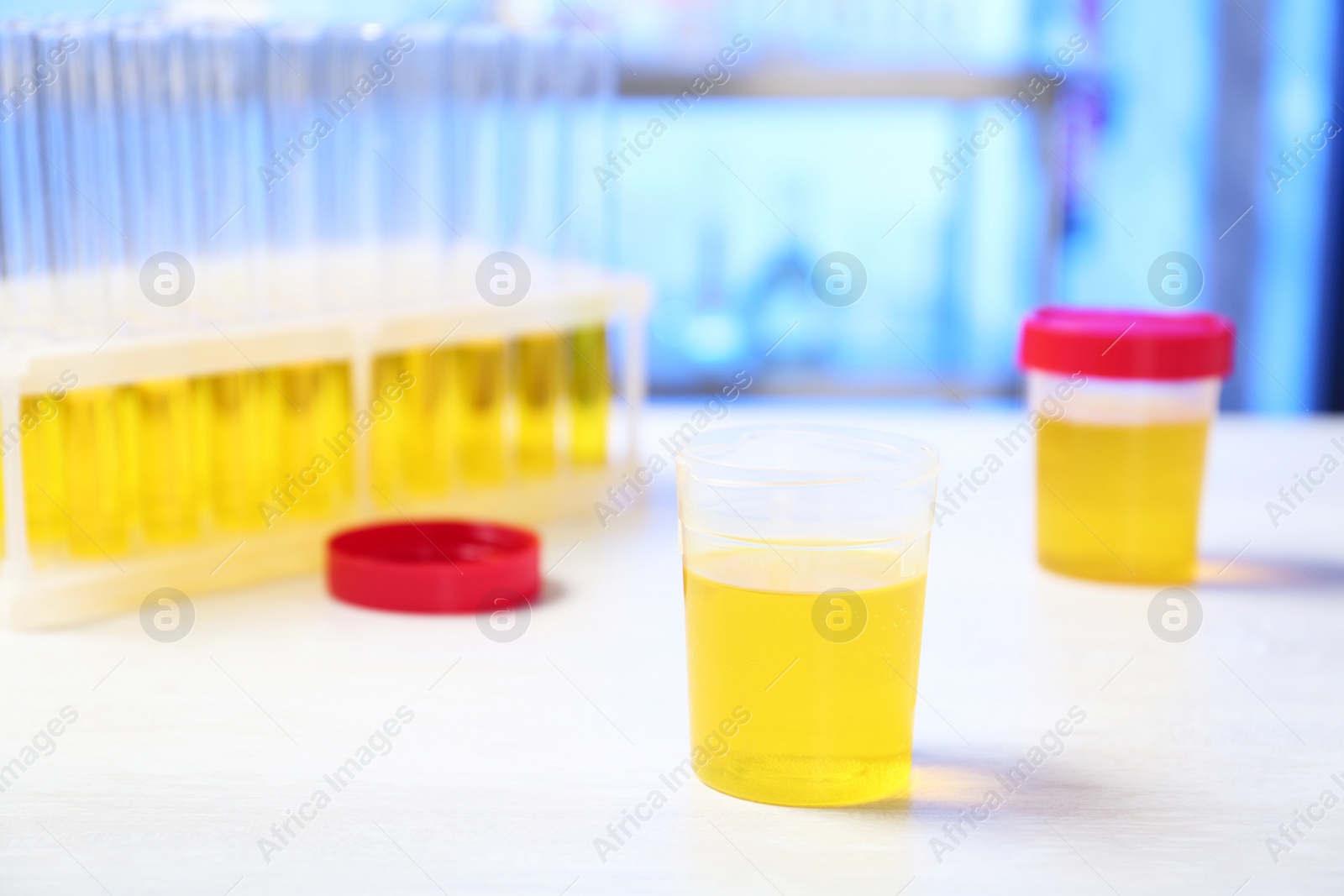 Photo of Container with urine sample for analysis on table in laboratory