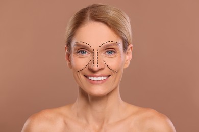 Image of Woman with markings for cosmetic surgery on her face against light brown background