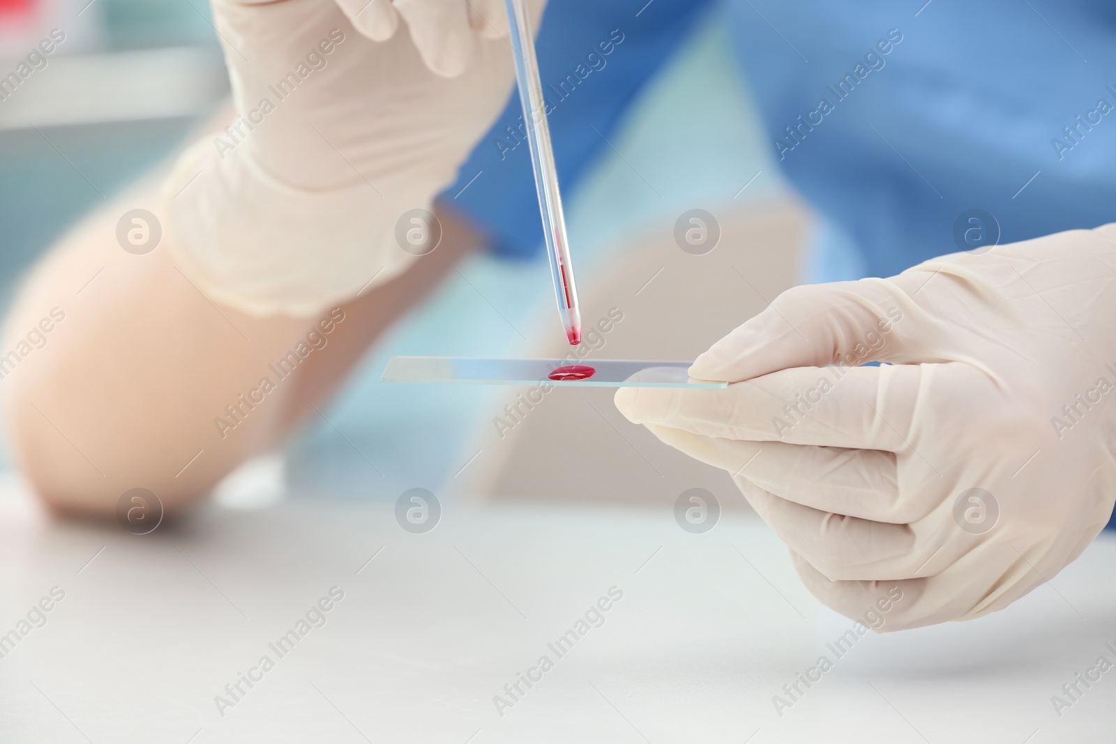 Photo of Scientist dripping blood sample on glass in laboratory