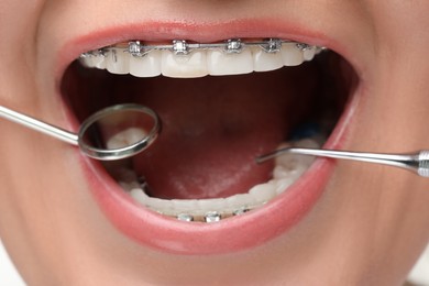 Photo of Examination of woman's teeth with braces using dental tools, closeup